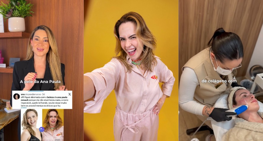 Ana Paula Renault revela rotina de beleza pré-BBB 26: procedimentos não invasivos em destaque