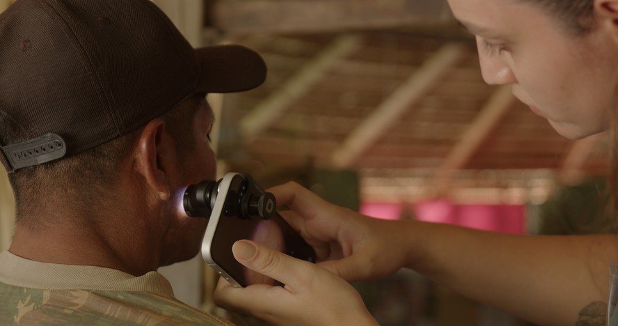 Tecnologia de triagem de câncer de pele sendo usada em comunidade ribeirinha